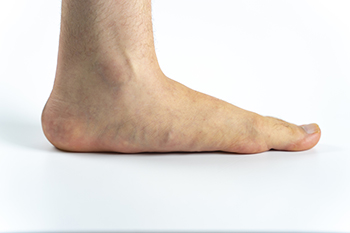 Side view of a human foot with flat arch