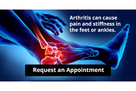 X-ray illustration of arthritic foot and ankle pain