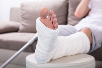Person with broken foot in white cast resting at home