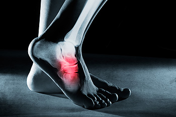 X-ray of human foot highlighting ankle pain in red