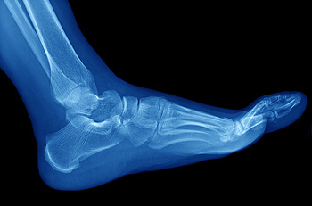 Blue X-ray image of human foot and ankle bones