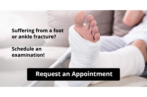 Foot in white medical cast for fracture treatment