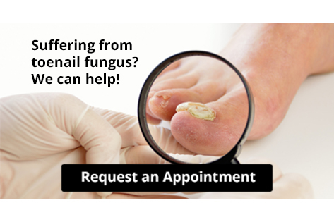 Doctor examining toenail fungus with magnifying glass