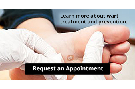 Doctor examining plantar wart on patient's foot