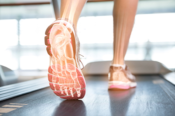 X-ray overlay of foot bones while running on treadmill