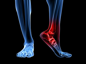 X-ray illustration of ankle pain with glowing red highlight