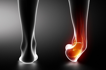 Medical illustration showing ankle pain and inflammation highlighted in red