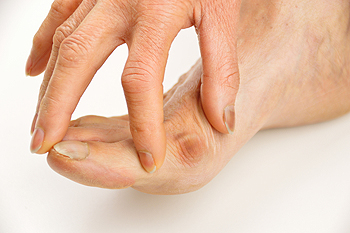 Hand touching painful bunion on foot toe joint