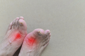 Feet with highlighted red areas indicating joint pain